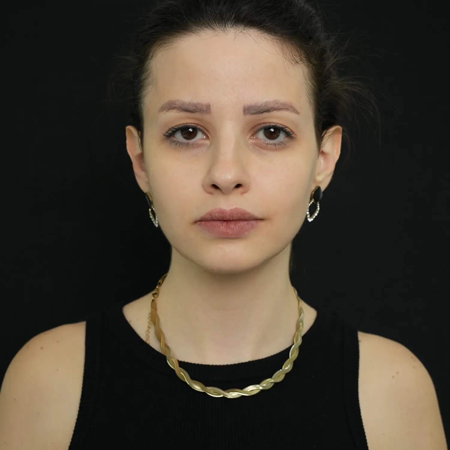Full face transformation - Achira clinics